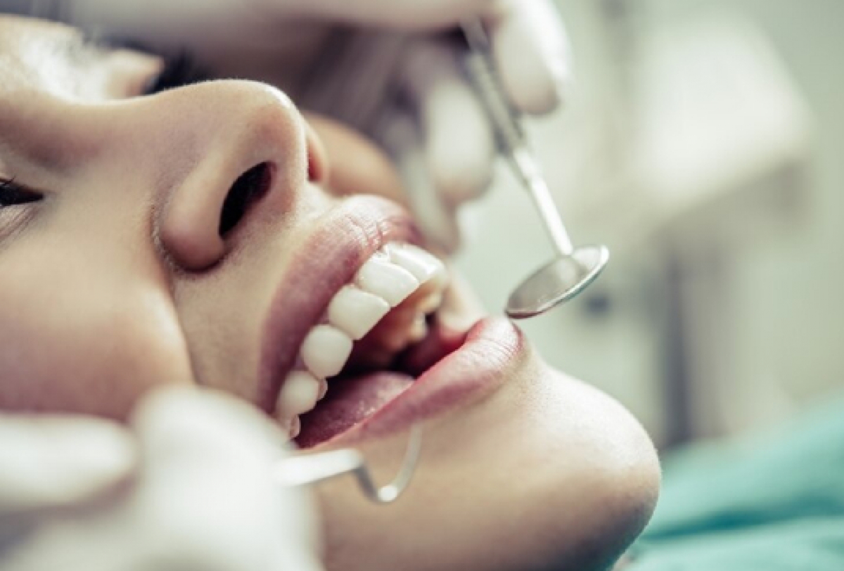 Imagem mostrando um tratamento dentário com uso de um espelho para verificar dentes ou gengivas.